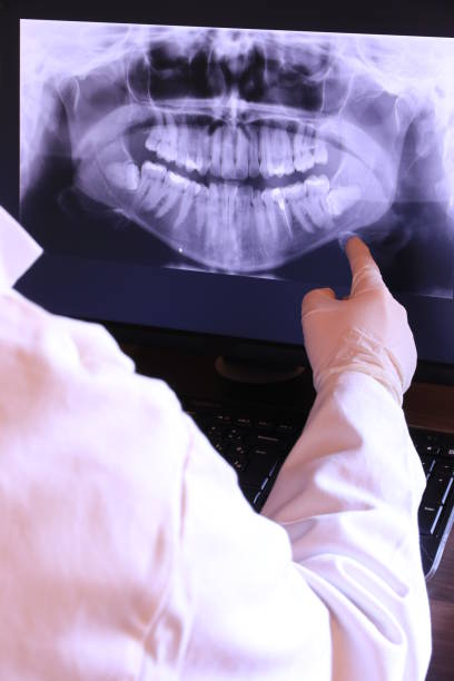 Best Emergency Wisdom Teeth Removal in Ke Charles, LA