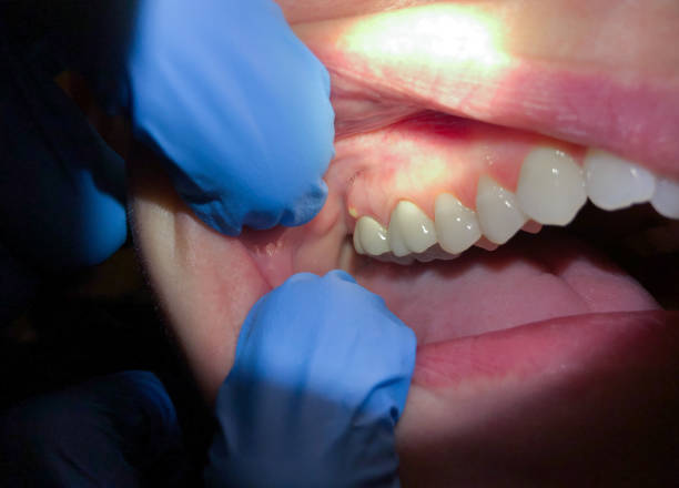 Best Pediatric Emergency Dentist in Ke Charles, LA